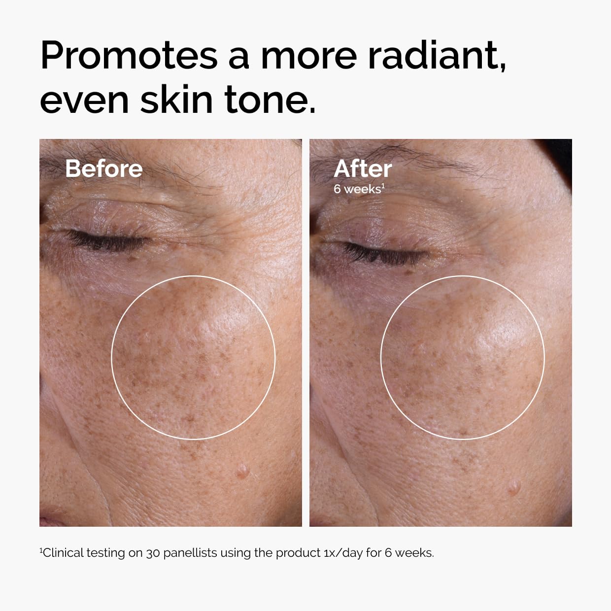 The Ordinary Glycolic Acid 7% Exfoliating Toner -  Brightening & Smoothing Toner for More Even-Looking Skin Tone