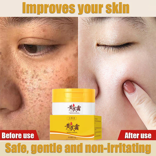 Dark Spots and Acne Removal Cream (BUY 1 GET 1 FREE)
