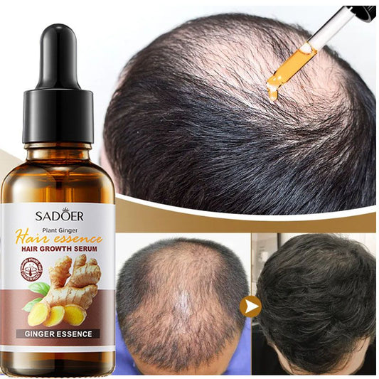 Ginger Hair Growth Serum - Promotes Stronger & Thicker Hair Growth for All Hair Types – (BUY 1 GET 1 FREE)